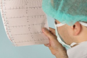 ניתוח בריאטרי לאחר ניתוח בלב - אפשר לבצע?